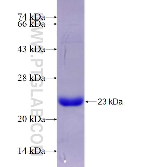 UBC12 fusion protein Ag5984 SDS-PAGE
