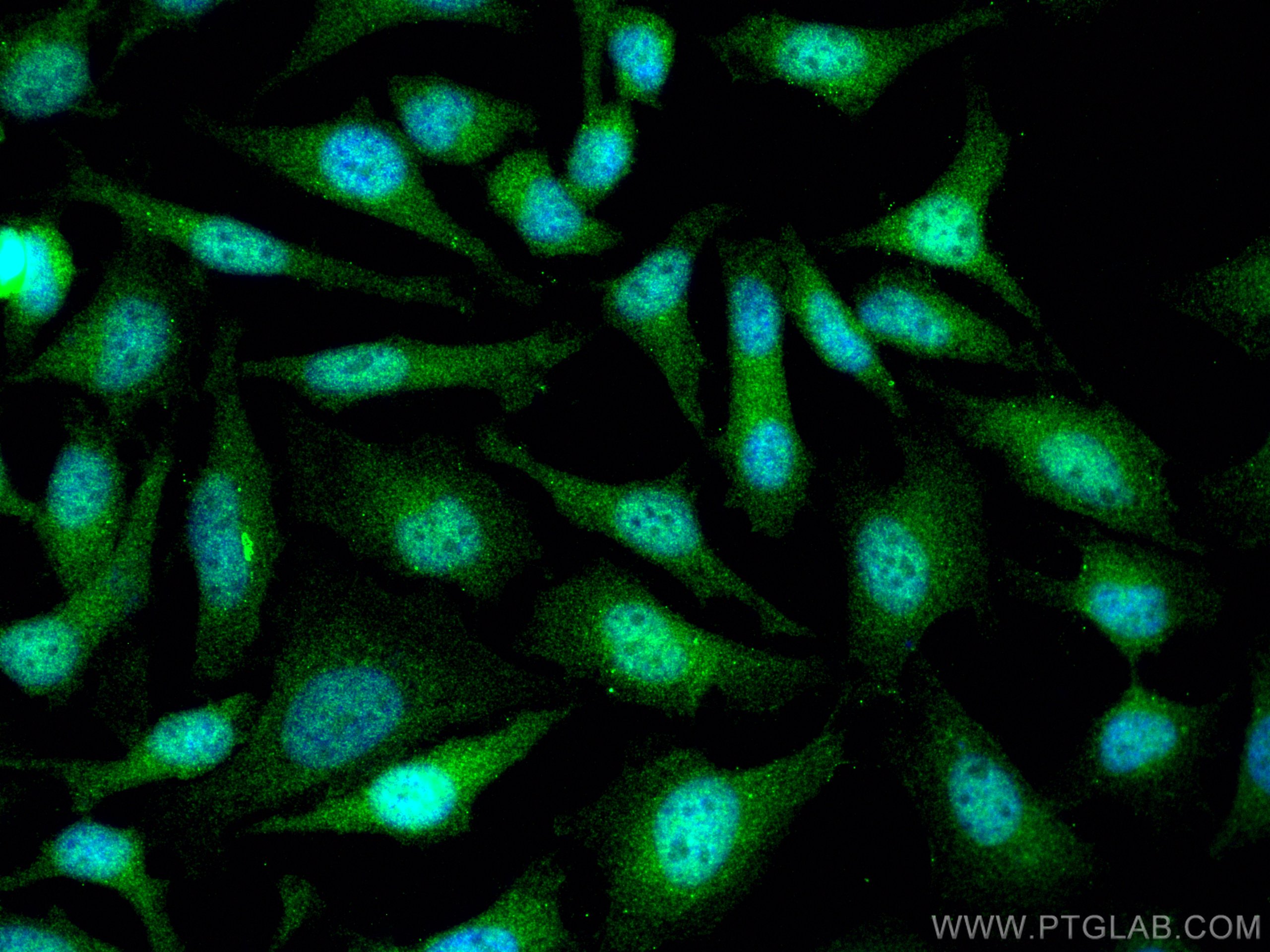 Immunofluorescence (IF) / fluorescent staining of HeLa cells using UBC9 Polyclonal antibody (10070-1-AP)