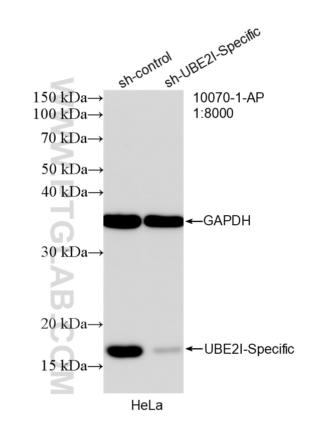 WB analysis of HeLa using 10070-1-AP Western Blot (WB) analysis of HeLa cells using UBC9 Polyclonal antibody (10070-1-AP)