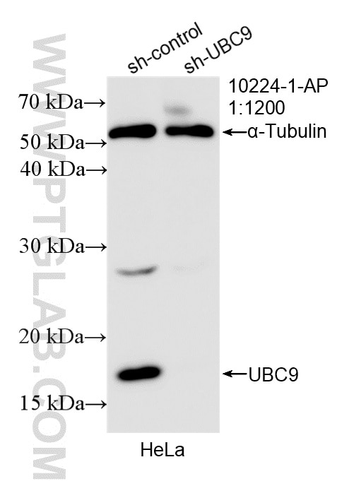 WB analysis of HeLa using 10224-1-AP Western Blot (WB) analysis of HeLa cells using UBC9 Polyclonal antibody (10224-1-AP)