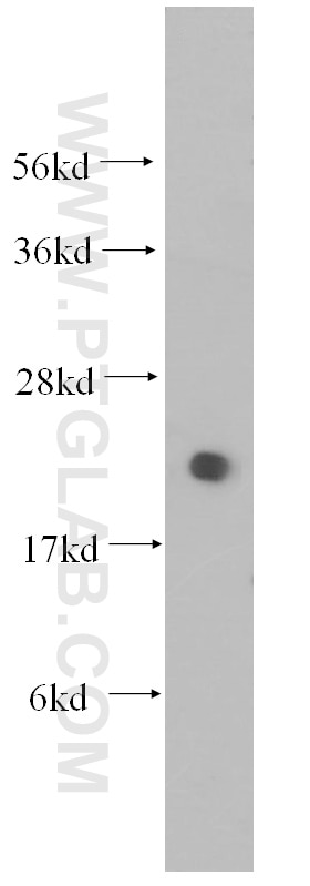 Western Blot (WB) analysis of Jurkat cells using UBC9 Polyclonal antibody (10224-1-AP)
