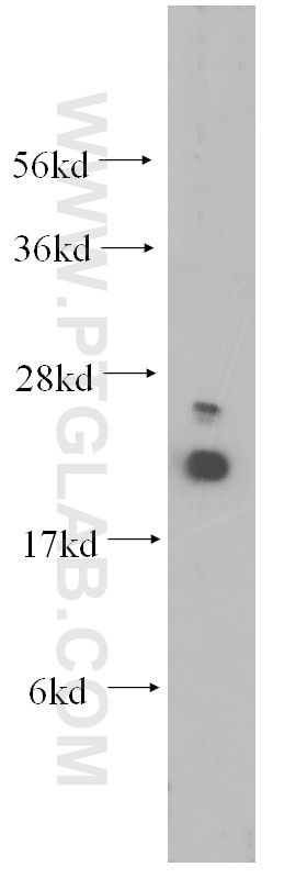 Western Blot (WB) analysis of Jurkat cells using UBC9 Polyclonal antibody (10224-1-AP)