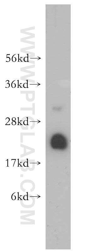 Western Blot (WB) analysis of human testis tissue using UBC9 Polyclonal antibody (10224-1-AP)