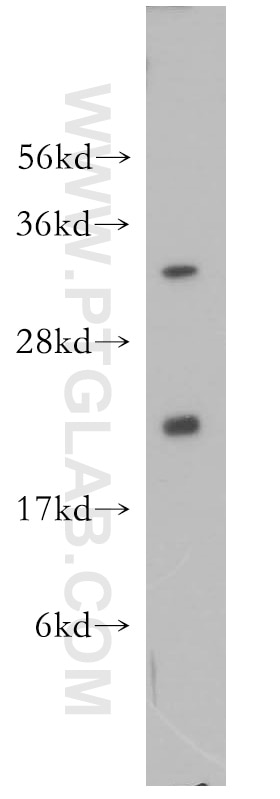 Western Blot (WB) analysis of HEK-293 cells using UBC9 Polyclonal antibody (10224-1-AP)