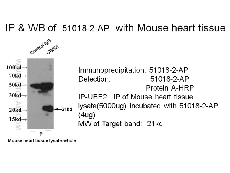 Immunoprecipitation (IP) experiment of mouse heart tissue using UBC9 Polyclonal antibody (51018-2-AP)