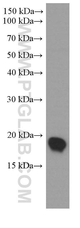 Western Blot (WB) analysis of rat kidney tissue using UBC9 Monoclonal antibody (60201-1-Ig)