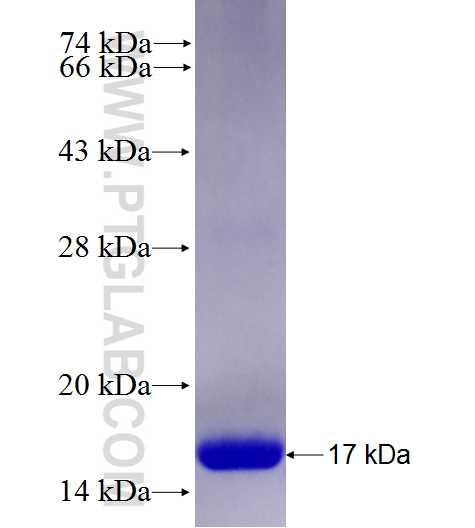 UBD fusion protein Ag27712 SDS-PAGE