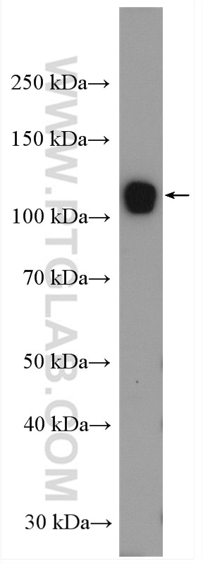 Western Blot (WB) analysis of HL-60 cells using UBE1 Polyclonal antibody (15912-1-AP)