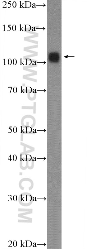 Western Blot (WB) analysis of mouse colon tissue using UBE1 Polyclonal antibody (15912-1-AP)