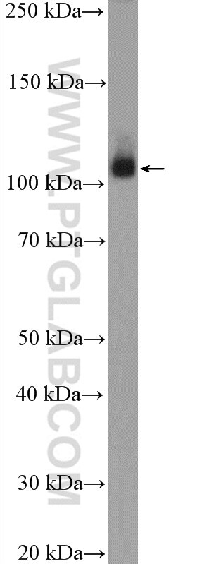 WB analysis of HeLa using 15912-1-AP