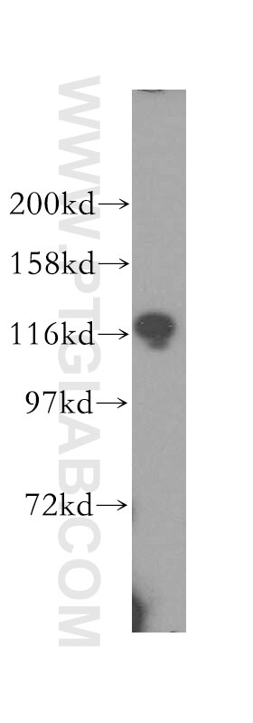 Western Blot (WB) analysis of HEK-293 cells using UBE1 Polyclonal antibody (15912-1-AP)