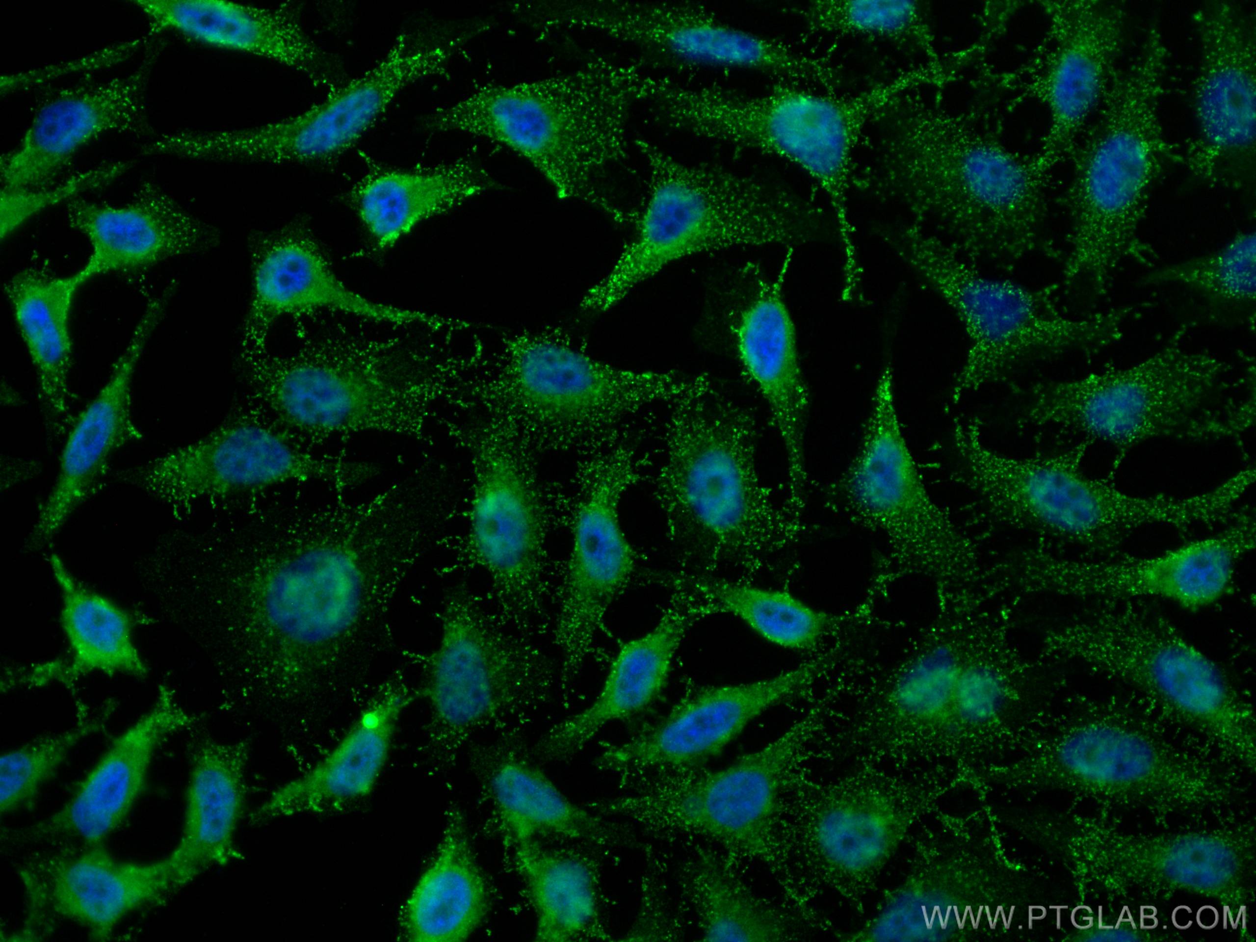 Immunofluorescence (IF) / fluorescent staining of HeLa cells using UBE1 Monoclonal antibody (67198-1-Ig)