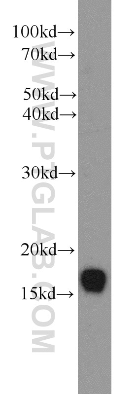 Western Blot (WB) analysis of human placenta tissue using UBE2A Polyclonal antibody (11080-1-AP)