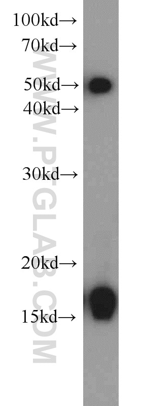 WB analysis of COLO 320 using 11080-1-AP