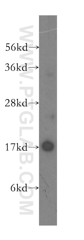 Western Blot (WB) analysis of human kidney tissue using UBE2A Polyclonal antibody (11080-1-AP)