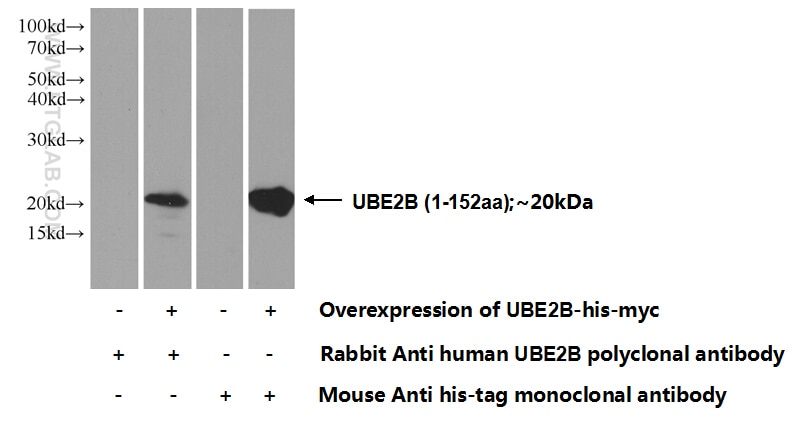 Western Blot (WB) analysis of Transfected HEK-293 cells using UBE2B Polyclonal antibody (10733-1-AP)