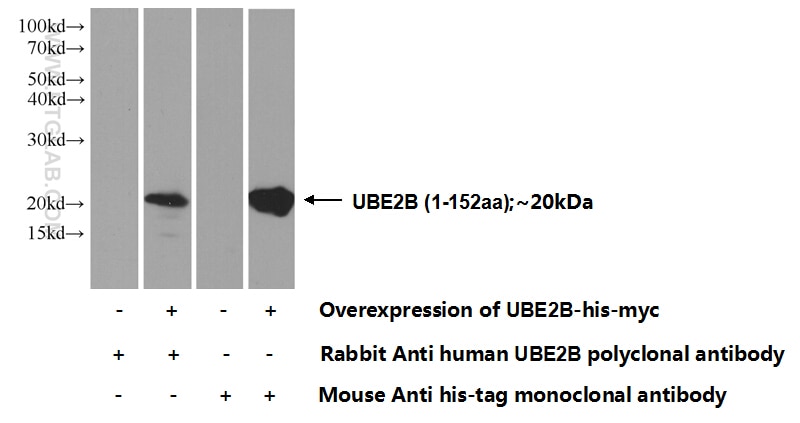 WB analysis of Transfected HEK-293 using 10733-1-AP