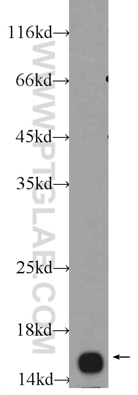 Western Blot (WB) analysis of L02 cells using UBE2B Polyclonal antibody (10733-1-AP)