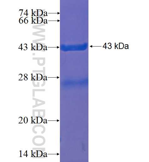 UBE2B fusion protein Ag1147 SDS-PAGE