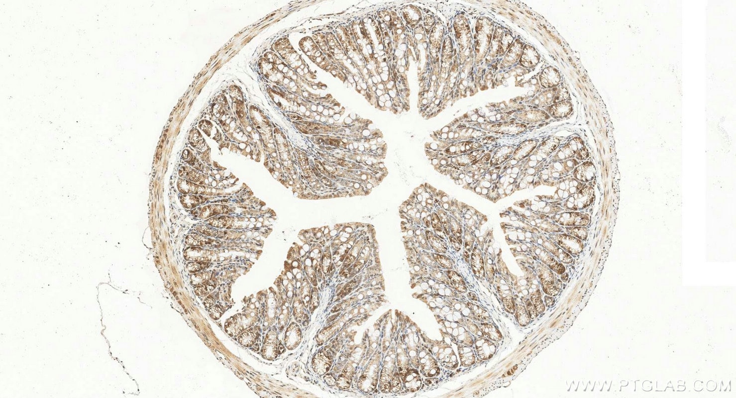 IHC staining of mouse colon using 12134-2-AP Immunohistochemistry (IHC) staining of mouse colon tissue using UBE2C Polyclonal antibody (12134-2-AP)