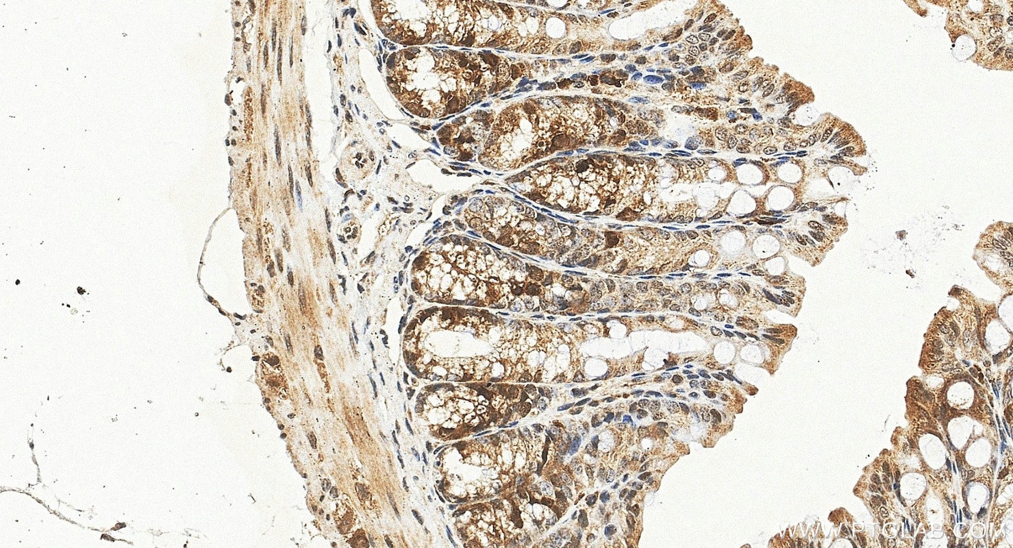 IHC staining of mouse colon using 12134-2-AP Immunohistochemistry (IHC) staining of mouse colon tissue using UBE2C Polyclonal antibody (12134-2-AP)