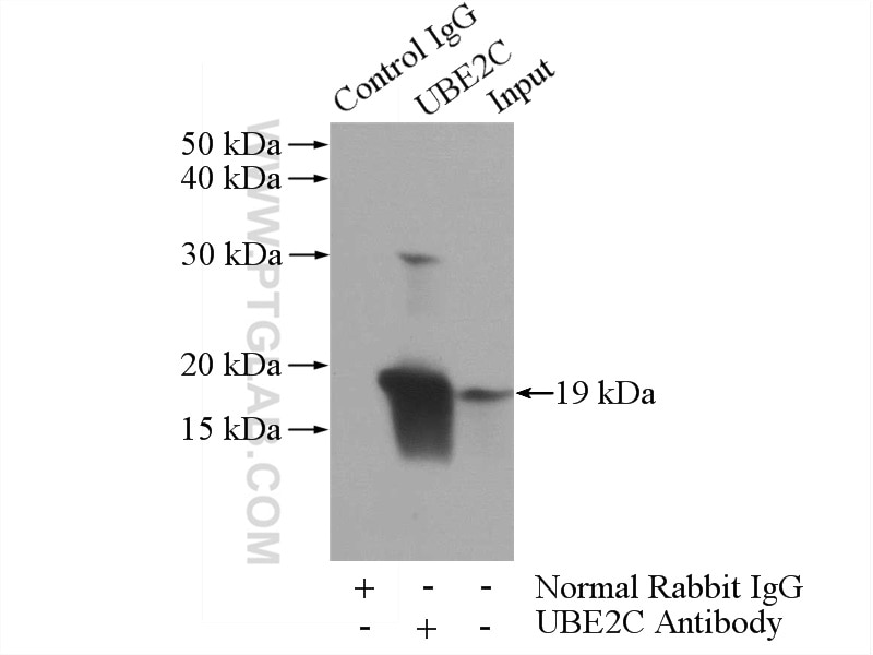 Immunoprecipitation (IP) experiment of HeLa cells using UBE2C Polyclonal antibody (12134-2-AP)