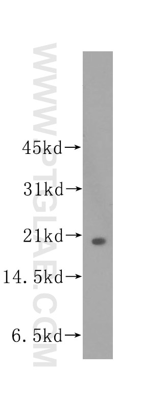 Western Blot (WB) analysis of HeLa cells using UBE2C Polyclonal antibody (12134-2-AP)