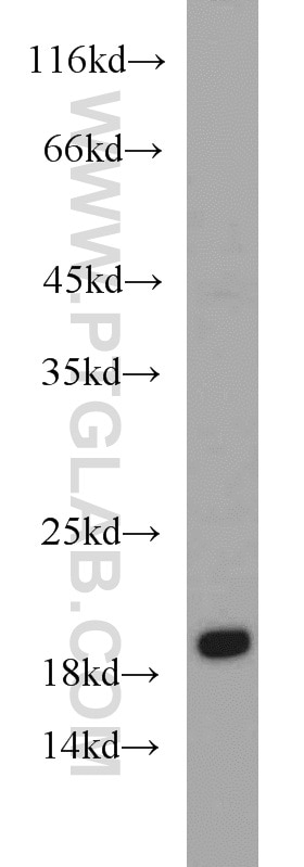 Western Blot (WB) analysis of HeLa cells using UBE2C Polyclonal antibody (12134-2-AP)