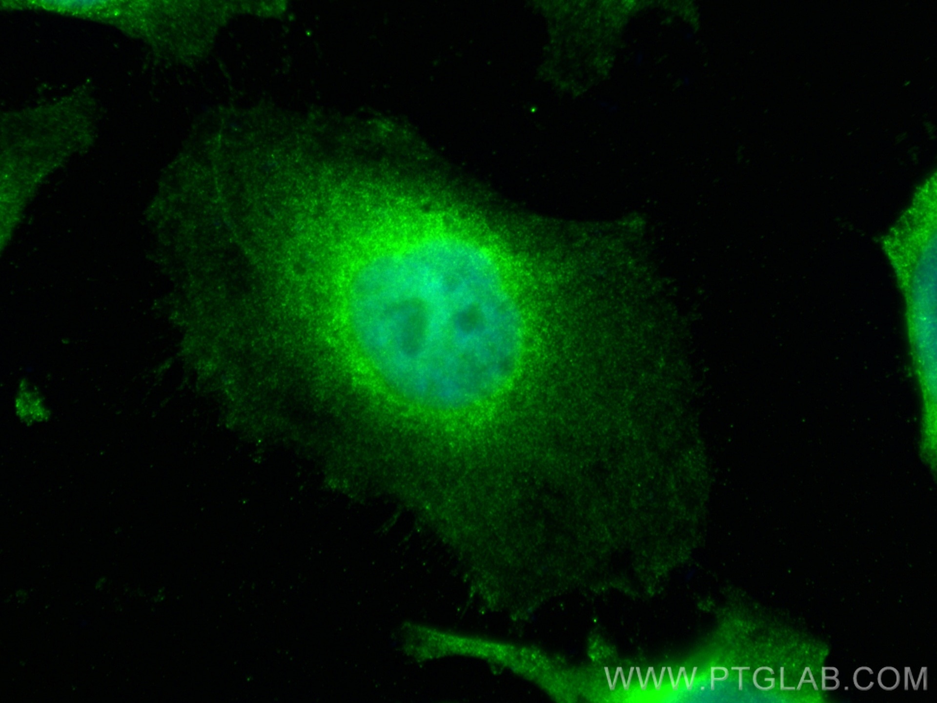 Immunofluorescence (IF) / fluorescent staining of HeLa cells using UBE2C Monoclonal antibody (66087-1-Ig)