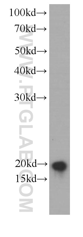 UBE2C Monoclonal antibody