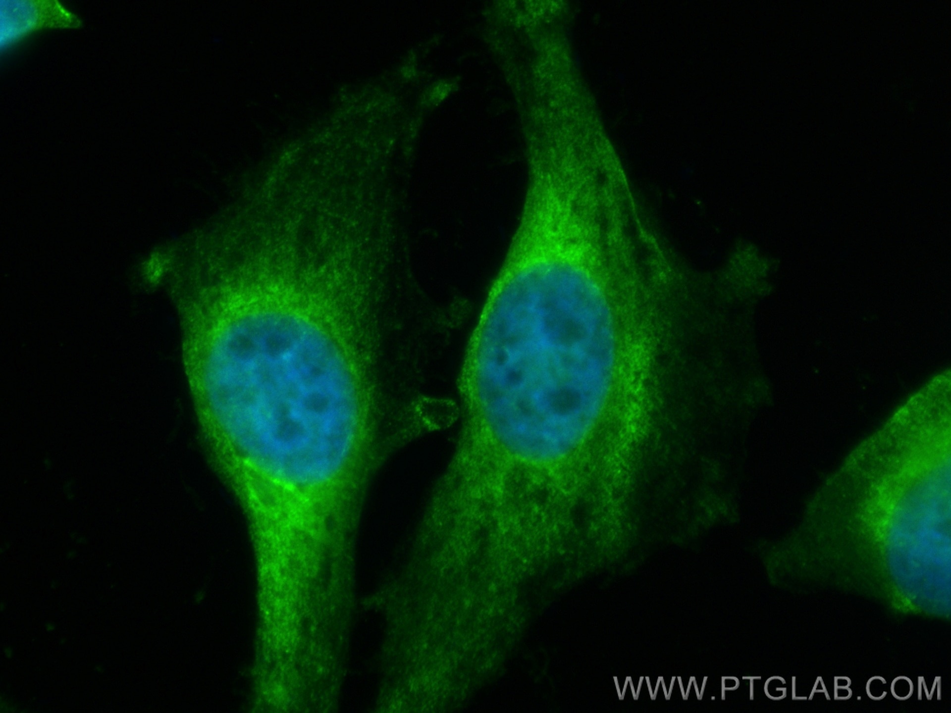 Immunofluorescence (IF) / fluorescent staining of HeLa cells using CoraLite® Plus 488-conjugated UBE2C Monoclonal ant (CL488-66087)