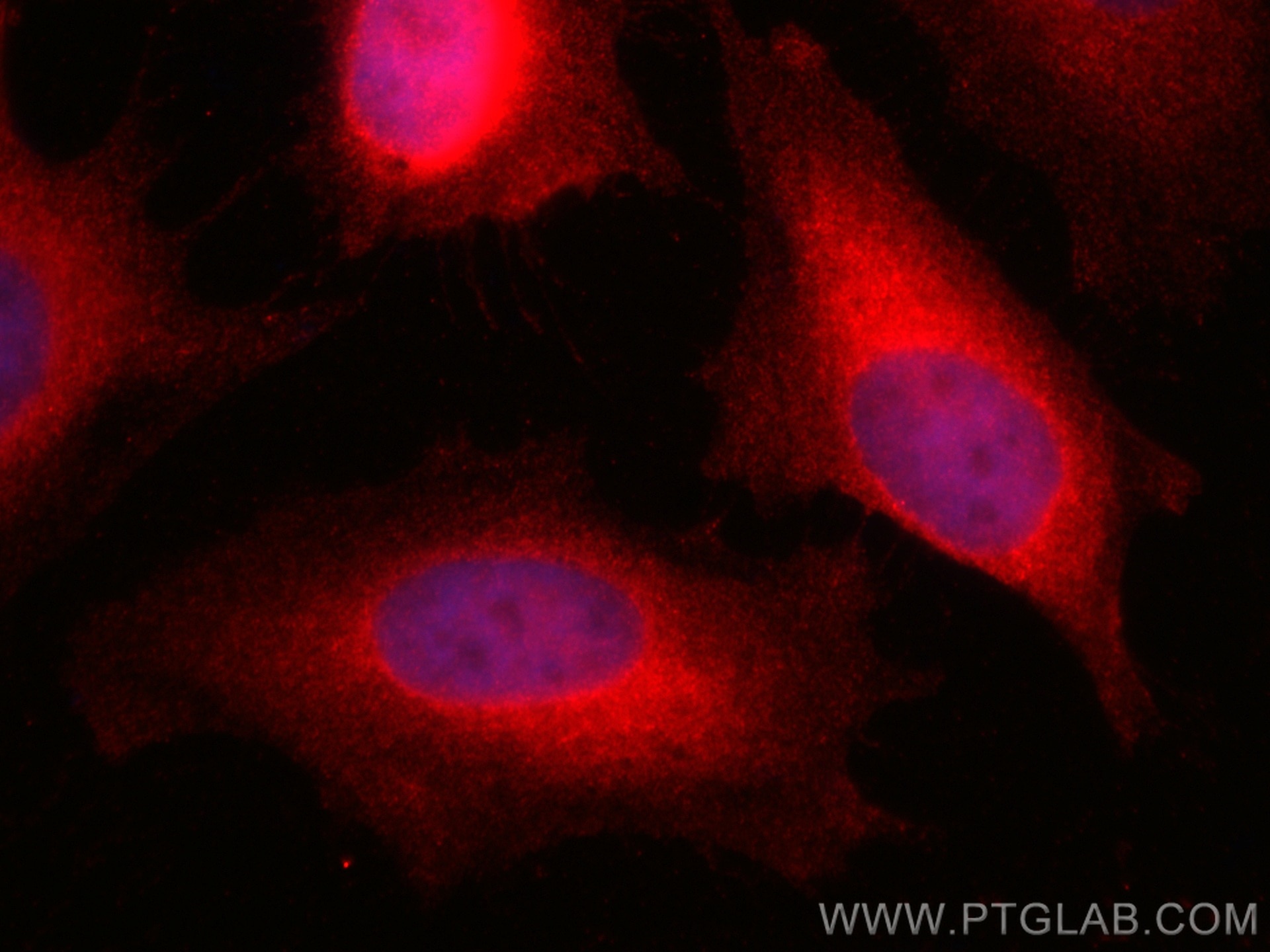 Immunofluorescence (IF) / fluorescent staining of HeLa cells using CoraLite®594-conjugated UBE2C Monoclonal antibody (CL594-66087)