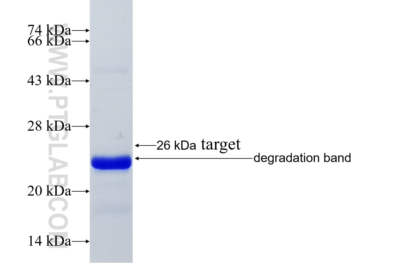 UBE2C fusion protein Ag19235 SDS-PAGE