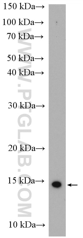 Western Blot (WB) analysis of MCF-7 cells using UBE2D1/2/3/4 Polyclonal antibody (28328-1-AP)