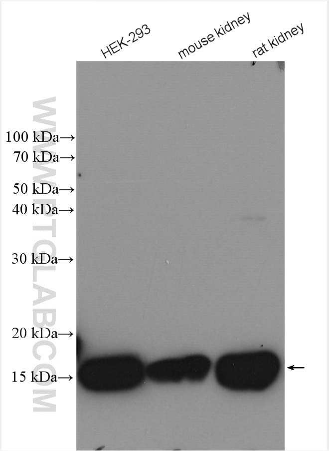 Western Blot (WB) analysis of various lysates using UBE2D1/2/3/4 Polyclonal antibody (28328-1-AP)