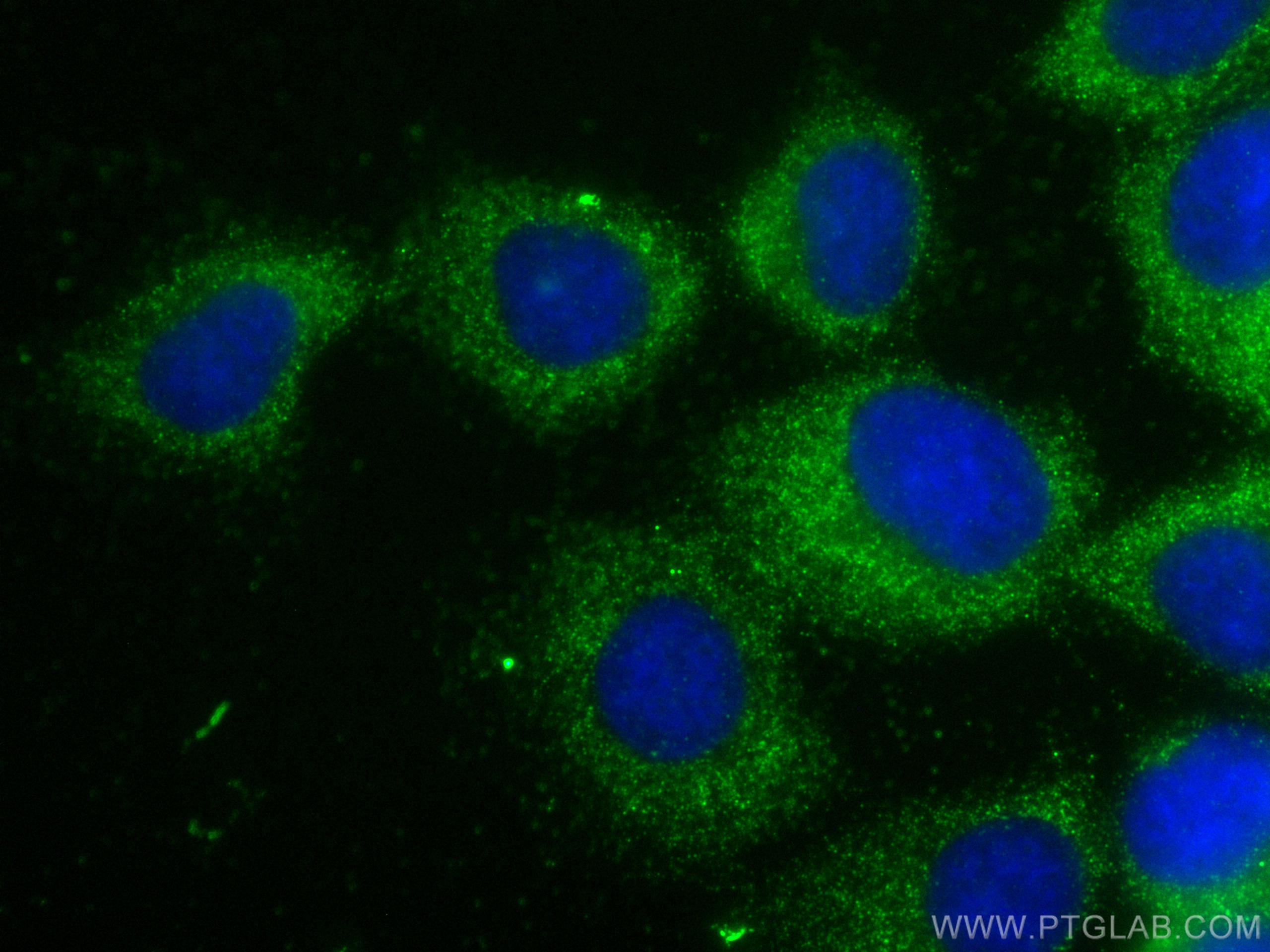 Immunofluorescence (IF) / fluorescent staining of A431 cells using UBE2D1/2/3/4 Monoclonal antibody (68138-1-Ig)