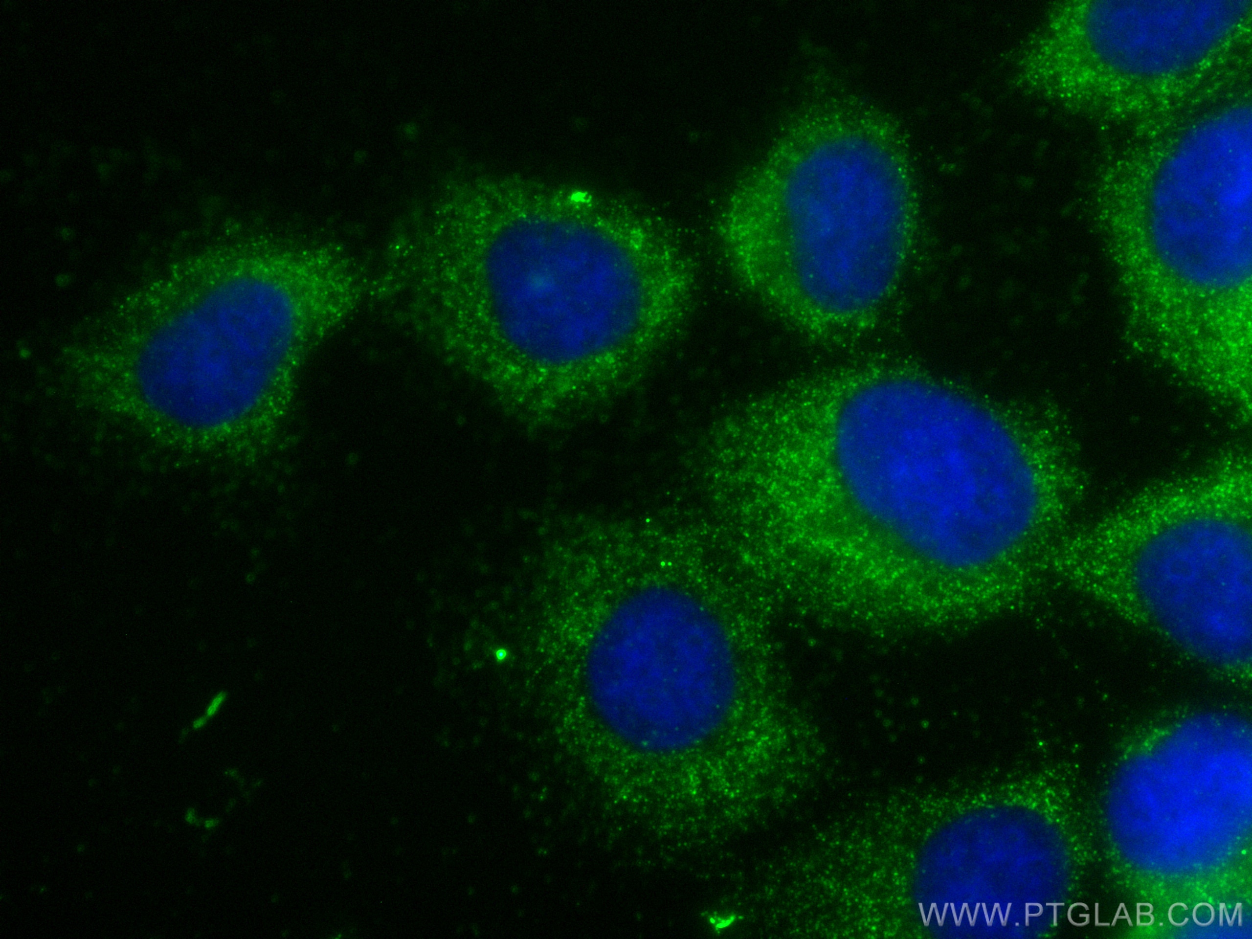 IF Staining of A431 using 68138-1-Ig