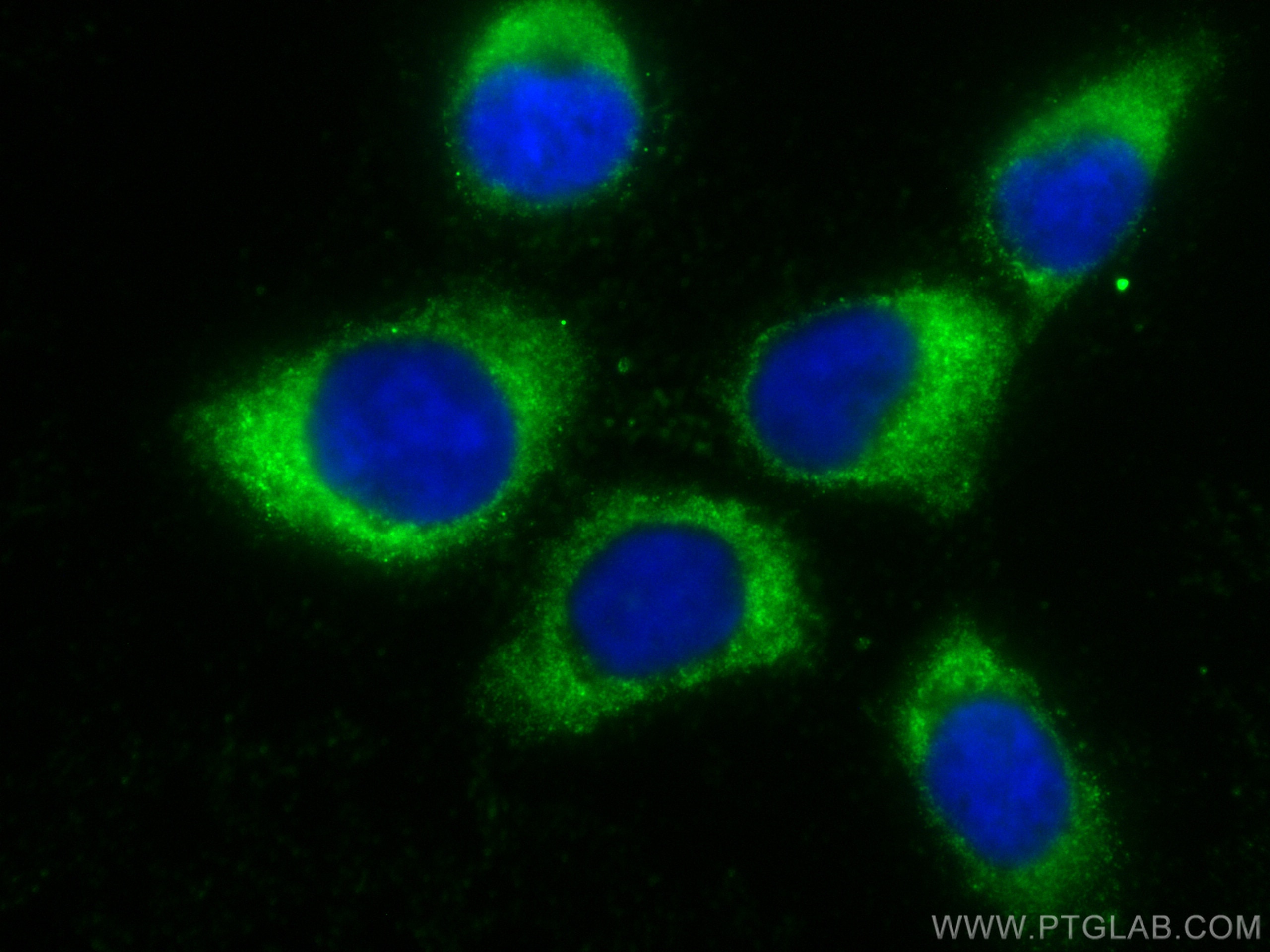 Immunofluorescence (IF) / fluorescent staining of A431 cells using CoraLite® Plus 488-conjugated UBE2D1/2/3/4 Monoclo (CL488-68138)