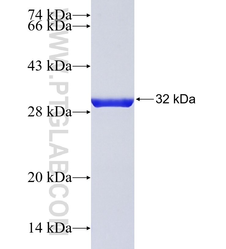 UBE2D2 fusion protein Ag28736 SDS-PAGE