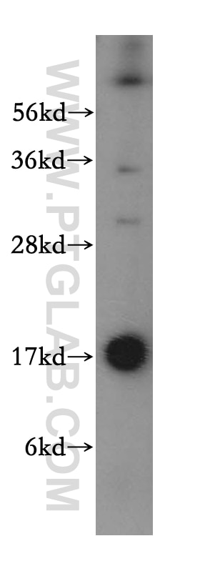 Western Blot (WB) analysis of mouse brain tissue using UBE2D1/2/3/4 Polyclonal antibody (15475-1-AP)