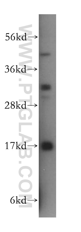 Western Blot (WB) analysis of human testis tissue using UBE2D1/2/3/4 Polyclonal antibody (15475-1-AP)
