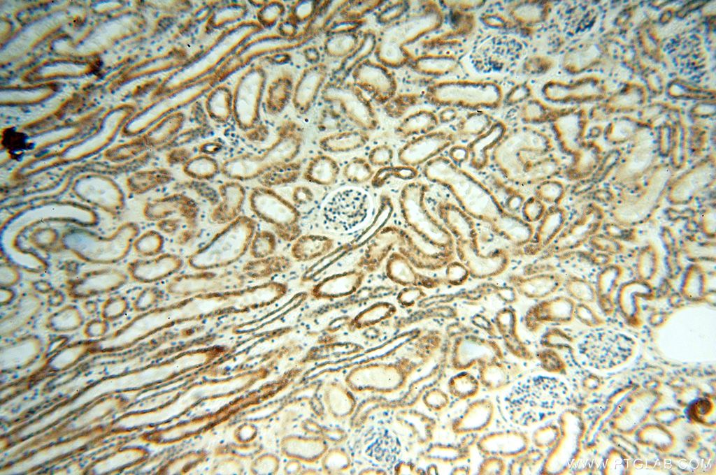 Immunohistochemistry (IHC) staining of human kidney tissue using UBE2DNL Polyclonal antibody (17287-1-AP)