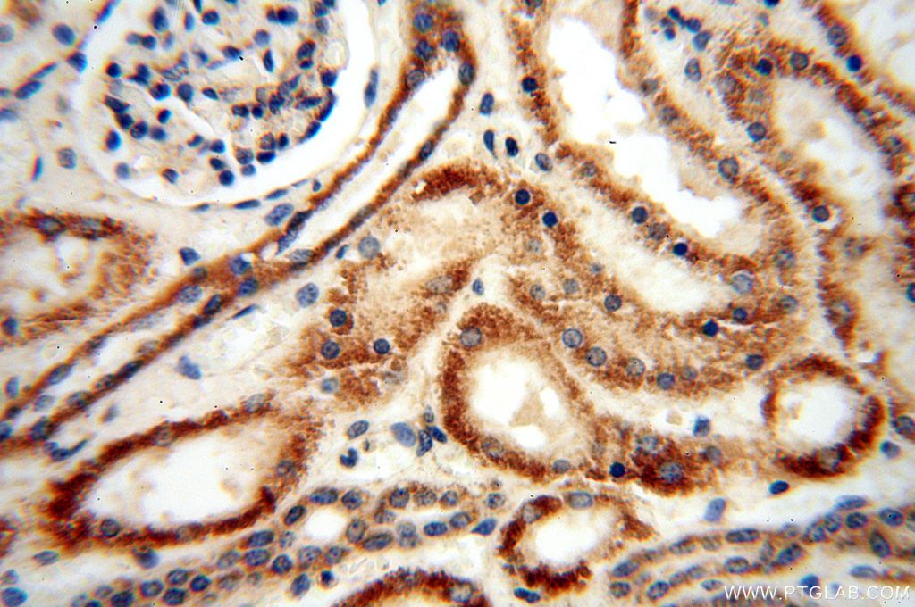 Immunohistochemistry (IHC) staining of human kidney tissue using UBE2DNL Polyclonal antibody (17287-1-AP)