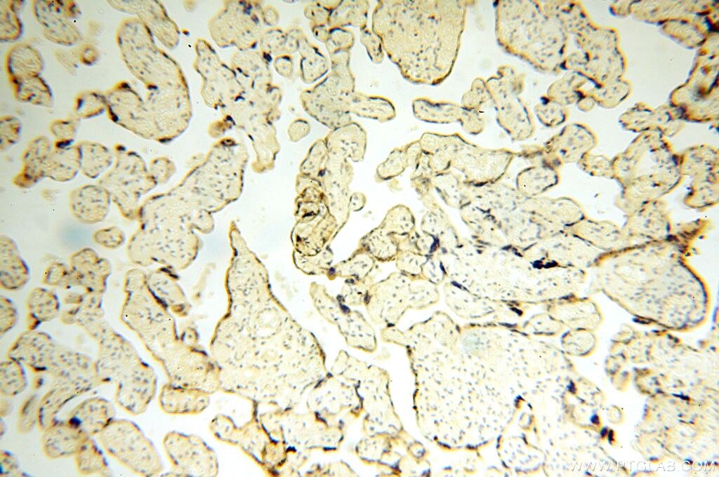 Immunohistochemistry (IHC) staining of human placenta tissue using UBE2DNL Polyclonal antibody (17287-1-AP)