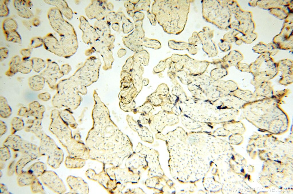 Immunohistochemistry (IHC) staining of human placenta tissue using UBE2DNL Polyclonal antibody (17287-1-AP)