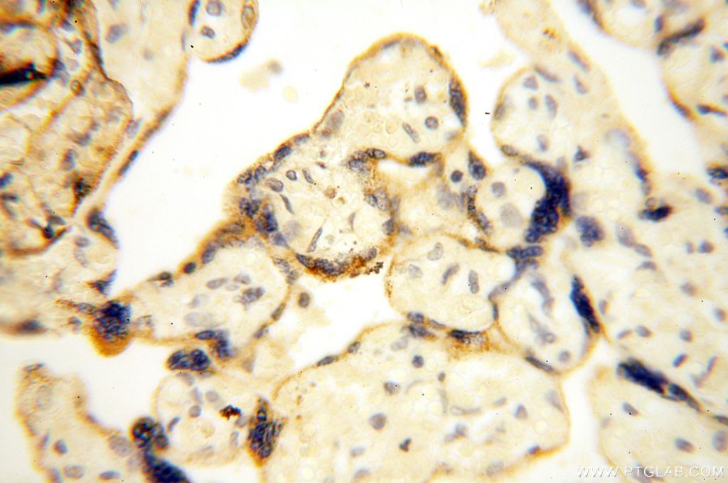 IHC staining of human placenta using 17287-1-AP