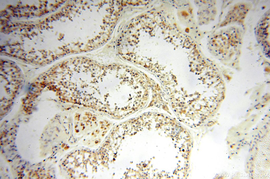 Immunohistochemistry (IHC) staining of human testis tissue using UBE2DNL Polyclonal antibody (17287-1-AP)