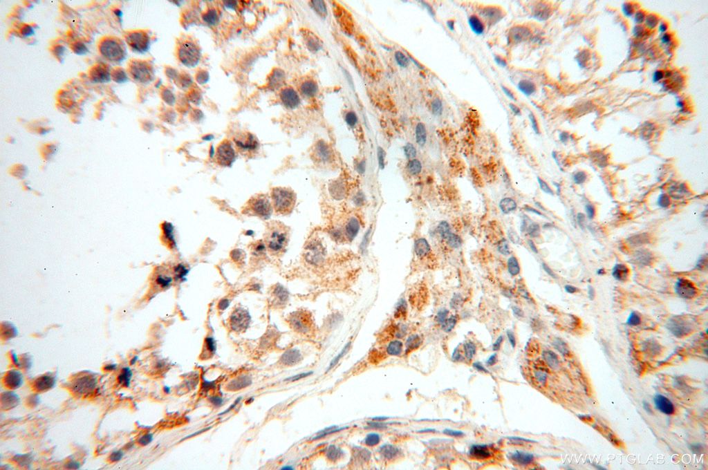 Immunohistochemistry (IHC) staining of human testis tissue using UBE2DNL Polyclonal antibody (17287-1-AP)