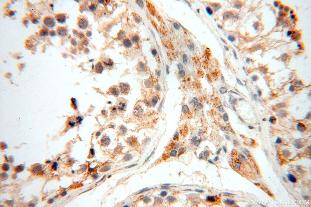 IHC staining of human testis using 17287-1-AP