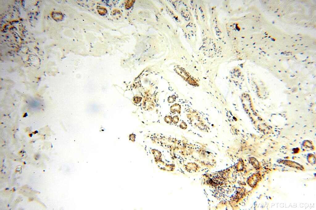 Immunohistochemistry (IHC) staining of human skin tissue using UBE2DNL Polyclonal antibody (17287-1-AP)